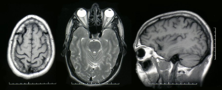 Image 20050318.MRI.web.jpg, size 57556 b